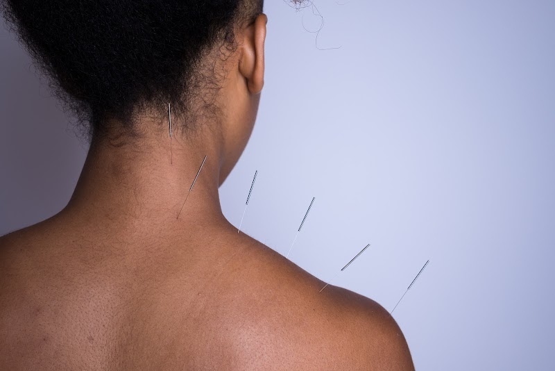 Emily Grace Acupuncture