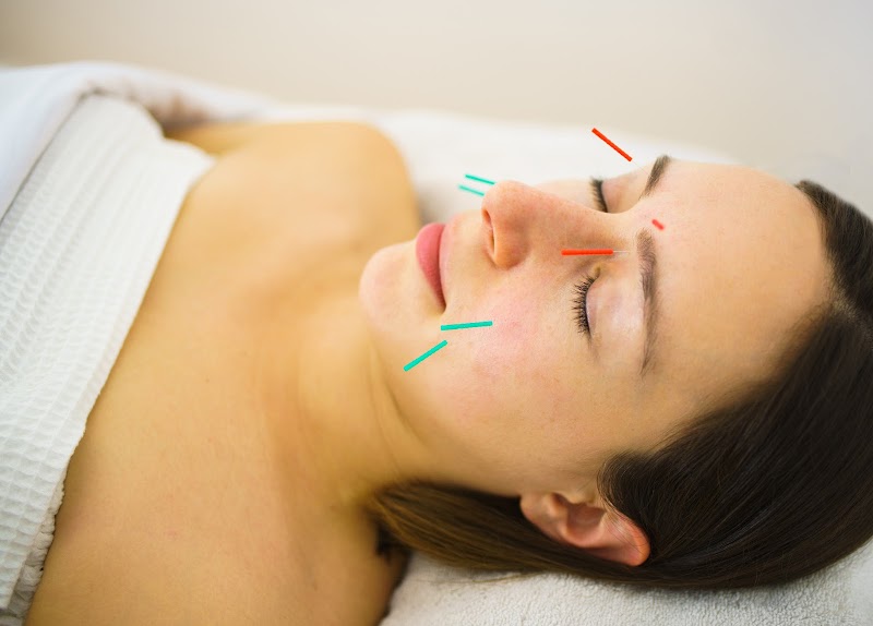 Lavenita Acupuncture and Wellness photo 4