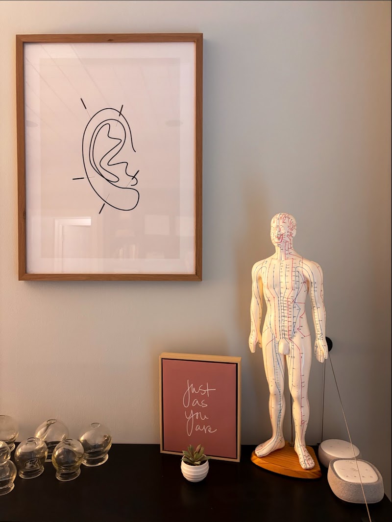 Tran Acupuncture photo 5